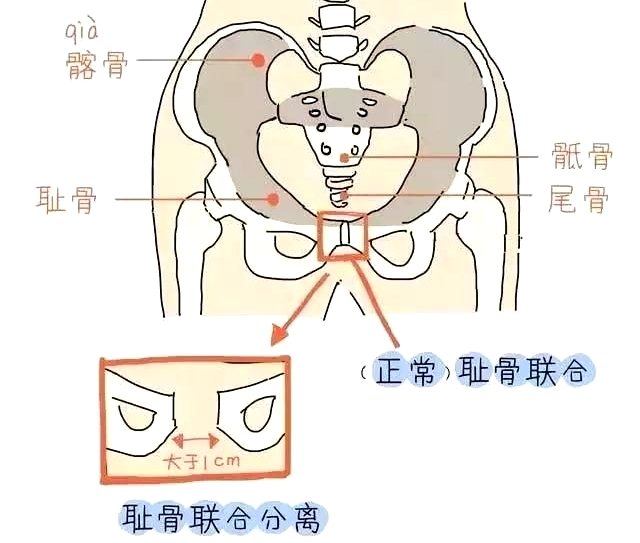 盆底肌康復(fù)治療儀，產(chǎn)后媽媽不再擔(dān)心