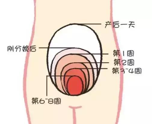 產(chǎn)后康復(fù)，什么叫子宮復(fù)舊不良？