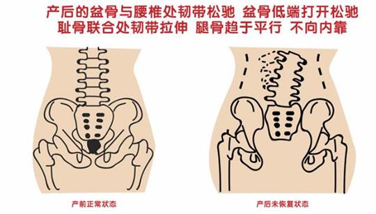 自從知道產(chǎn)后康復治療儀后，再也不怕腹直肌修復了