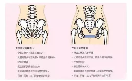 產(chǎn)后修復治療儀器對于腹直肌修復有效果嗎？