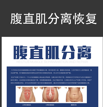 馬麗挺孕肚登春晚，孕婦還應(yīng)該知道腹直肌分離的相關(guān)知識(shí)