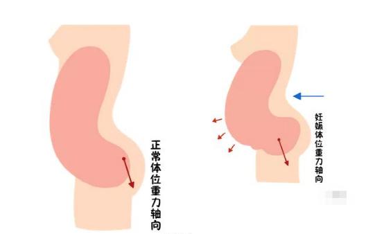 盆底恢復(fù)是否可以使用儀器？