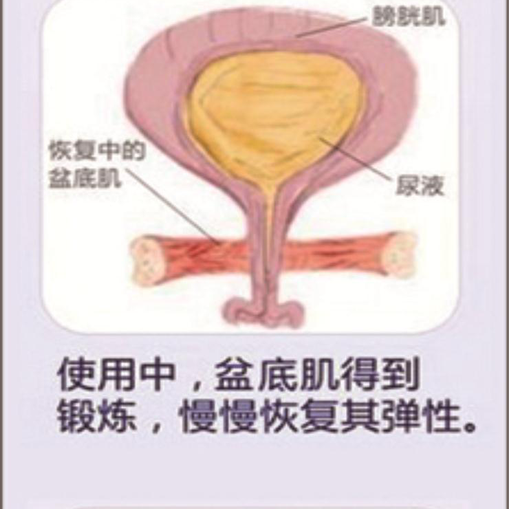 盆底肌康復(fù)治療