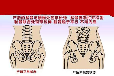 產(chǎn)后腰背痛